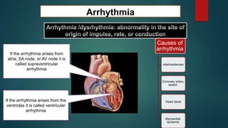 Arrhythmia
If the arrhythmia arises from the
ventricles it is called ventricular
arrhythmia
If the arrhythmia arises from
atria, SA node, or AV node it is
called supraventricular
arrhythmia
Causes of
arrhythmia
arteriosclerosis
Coronary artery
spasm
Heart block
Myocardial
ischemia
 