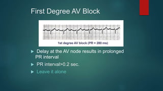 First Degree AV Block
 Delay at the AV node results in prolonged
PR interval
 PR interval>0.2 sec.
 Leave it alone
 