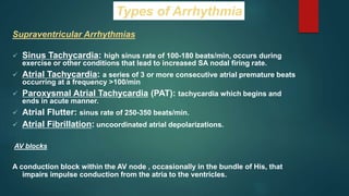 Supraventricular Arrhythmias
 Sinus Tachycardia: high sinus rate of 100-180 beats/min, occurs during
exercise or other conditions that lead to increased SA nodal firing rate.
 Atrial Tachycardia: a series of 3 or more consecutive atrial premature beats
occurring at a frequency >100/min
 Paroxysmal Atrial Tachycardia (PAT): tachycardia which begins and
ends in acute manner.
 Atrial Flutter: sinus rate of 250-350 beats/min.
 Atrial Fibrillation: uncoordinated atrial depolarizations.
AV blocks
A conduction block within the AV node , occasionally in the bundle of His, that
impairs impulse conduction from the atria to the ventricles.
Types of Arrhythmia
 