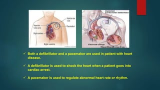  Both a defibrillator and a pacemaker are used in patient with heart
disease.
 A defibrillator is used to shock the heart when a patient goes into
cardiac arrest.
 A pacemaker is used to regulate abnormal heart rate or rhythm.
 