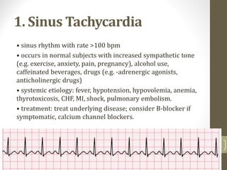 1. Sinus Tachycardia
• sinus rhythm with rate >100 bpm
• occurs in normal subjects with increased sympathetic tone
(e.g. exercise, anxiety, pain, pregnancy), alcohol use,
caffeinated beverages, drugs (e.g. -adrenergic agonists,
anticholinergic drugs)
• systemic etiology: fever, hypotension, hypovolemia, anemia,
thyrotoxicosis, CHF, MI, shock, pulmonary embolism.
• treatment: treat underlying disease; consider B-blocker if
symptomatic, calcium channel blockers.
16
 