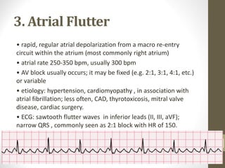 3. Atrial Flutter
• rapid, regular atrial depolarization from a macro re-entry
circuit within the atrium (most commonly right atrium)
• atrial rate 250-350 bpm, usually 300 bpm
• AV block usually occurs; it may be fixed (e.g. 2:1, 3:1, 4:1, etc.)
or variable
• etiology: hypertension, cardiomyopathy , in association with
atrial fibrillation; less often, CAD, thyrotoxicosis, mitral valve
disease, cardiac surgery.
• ECG: sawtooth flutter waves in inferior leads (II, III, aVF);
narrow QRS , commonly seen as 2:1 block with HR of 150.
18
 