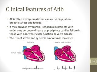 Clinical features of Afib
• AF is often asymptomatic but can cause palpitation,
breathlessness and fatigue.
• It may provoke myocardial ischaemia in patients with
underlying coronary disease or precipitate cardiac failure in
those with poor ventricular function or valve disease.
• The risk of stroke and systemic embolism is increased.
24
 