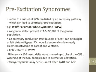 Pre-Excitation Syndromes
• refers to a subset of SVTs mediated by an accessory pathway
which can lead to ventricular pre-excitation.
e.g. Wolff-Parkinson-White Syndrome (WPW)
• congenital defect present in 1.5-2/1000 of the general
population.
• an accessory conduction tract (Bundle of Kent; can be in right
or left atrium) Bypass AV node & abnormally allows early
electrical activation of part of one ventricle.
• ECG features of WPW
PR interval <120 msec, delta wave: slurred upstroke of the QRS ,
widening of the QRS complex due to premature activation.
- Tachyarrhythmias may occur – most often AVRT and AFib 28
 