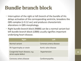 Bundle branch block
• Interruption of the right or left branch of the bundle of His
delays activation of the corresponding ventricle, broadens the
QRS complex (≥ 0.12 sec) and produces characteristic
alterations in QRS morphology.
• Right bundle branch block (RBBB) can be a normal variant but
left bundle branch block (LBBB) usually signifies important
underlying heart disease.
38
Right Left
Normal variant Coronary artery disease
RV hypertrophy or strain Aortic valve disease
Congenital heart disease, e.g.
atrial septal defect
Hypertension
Coronary artery disease Cardiomyopathy
 