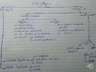 arrhythbbbbbbbbbbbbbbbbbbbbbbbbmia .pptx