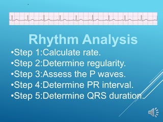 Rhythm Analysis
•Step 1:Calculate rate.
•Step 2:Determine regularity.
•Step 3:Assess the P waves.
•Step 4:Determine PR interval.
•Step 5:Determine QRS duration.
 