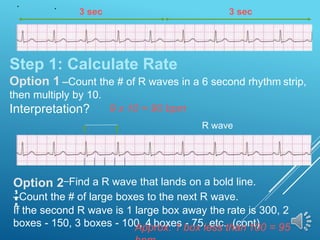 Step 1: Calculate Rate
Option 1 –Count the # of R waves in a 6 second rhythm strip,
then multiply by 10.
Interpretation? 9 x 10 = 90 bpm
3 sec
3 sec
Option 2–Find a R wave that lands on a bold line.
–Count the # of large boxes to the next R wave.
If the second R wave is 1 large box away the rate is 300, 2
boxes - 150, 3 boxes - 100, 4 boxes - 75, etc. (cont)
R wave
3
0
0
1
5
0
1
0
0
7
5
6
0
5
0
Approx. 1 box less than 100 = 95
 