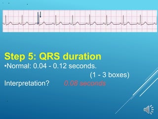 Step 5: QRS duration
•Normal: 0.04 - 0.12 seconds.
(1 - 3 boxes)
Interpretation? 0.08 seconds
 