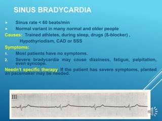 SINUS BRADYCARDIA
 Sinus rate < 60 beats/min
 Normal variant in many normal and older people
Causes: Trained athletes, during sleep, drugs (ß-blocker) ,
Hypothyriodism, CAD or SSS
Symptoms:
1. Most patients have no symptoms.
2. Severe bradycardia may cause dizziness, fatigue, palpitation,
even syncope.
Needn’t specific therapy, If the patient has severe symptoms, planted
an pacemaker may be needed.
 