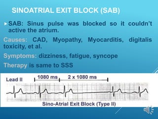 SINOATRIAL EXIT BLOCK (SAB)
SAB: Sinus pulse was blocked so it couldn’t
active the atrium.
Causes: CAD, Myopathy, Myocarditis, digitalis
toxicity, et al.
Symptoms: dizziness, fatigue, syncope
Therapy is same to SSS
 