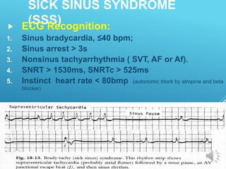 SICK SINUS SYNDROME
(SSS)
 ECG Recognition:
1. Sinus bradycardia, ≤40 bpm;
2. Sinus arrest > 3s
3. Nonsinus tachyarrhythmia ( SVT, AF or Af).
4. SNRT > 1530ms, SNRTc > 525ms
5. Instinct heart rate < 80bmp (autonomic block by atropine and beta
blocker)
 