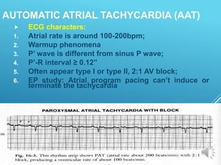 AUTOMATIC ATRIAL TACHYCARDIA (AAT)
 ECG characters:
1. Atrial rate is around 100-200bpm;
2. Warmup phenomena
3. P’ wave is different from sinus P wave;
4. P’-R interval ≥ 0.12”
5. Often appear type I or type II, 2:1 AV block;
6. EP study: Atrial program pacing can’t induce or
terminate the tachycardia
 