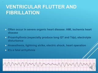 VENTRICULAR FLUTTER AND
FIBRILLATION
 Often occur in severe organic heart disease: AMI, ischemia heart
disease
 Proarrhythmia (especially produce long QT and Tdp), electrolyte
disturbance
 Anaesthesia, lightning strike, electric shock, heart operation
 It’s a fatal arrhythmia
 