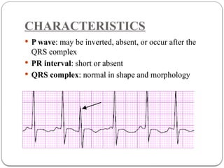 Cardiac Arrhythmias for paramedical students. | PPTX
