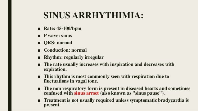 How Do You Treat Sinus Arrhythmia How Do You Treat Sinus Arrhythmia