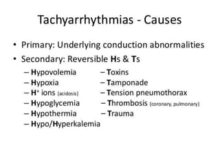 Arrhythmia 