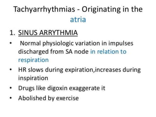 Arrhythmia 