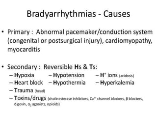 Arrhythmia 