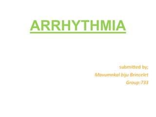ARRHYTHMIA
submitted by;
Mavumnkal biju Brincelet
Group:733
 