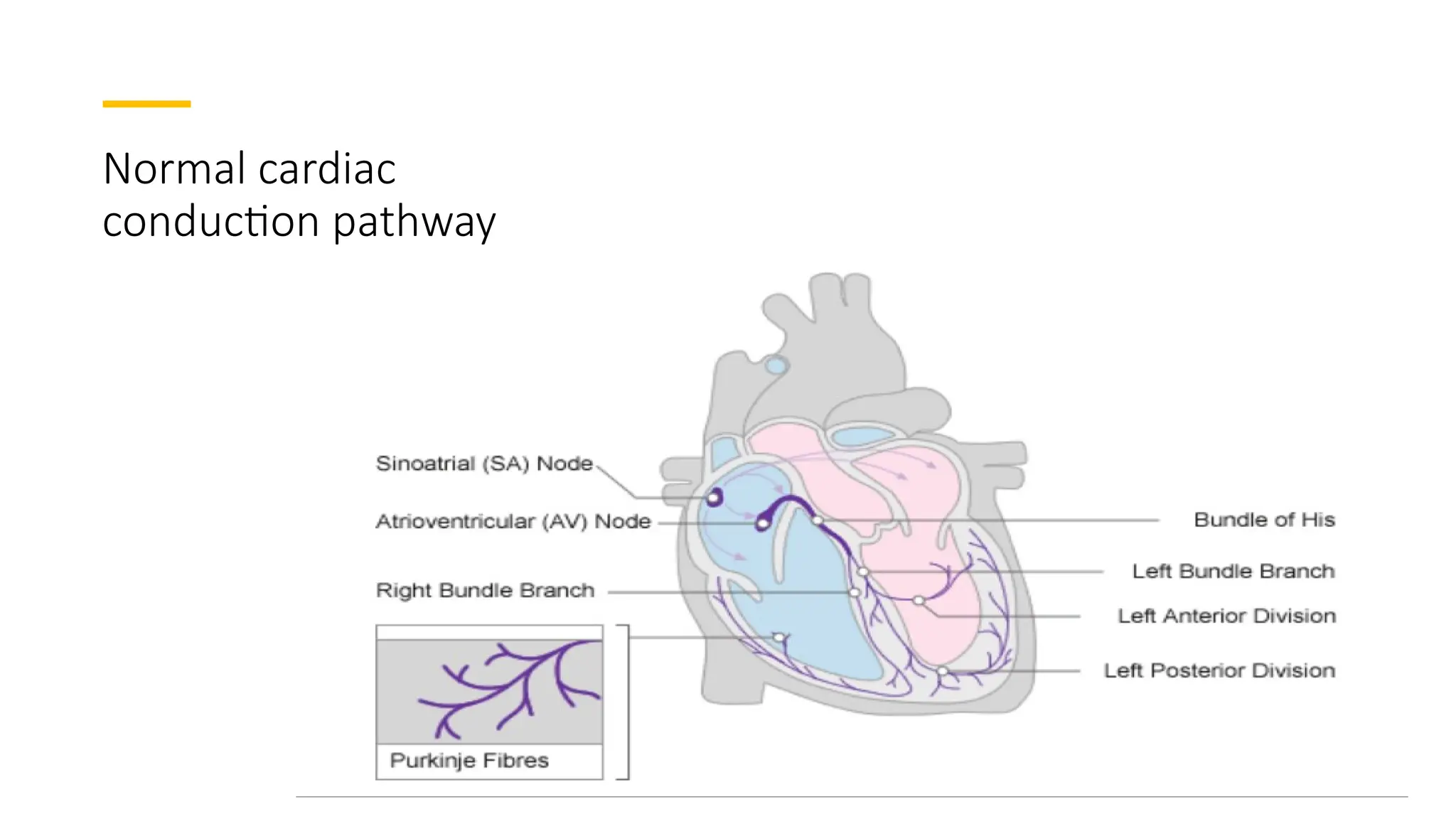 4
Normal cardiac
conduction pathway
 