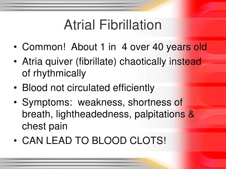 Arrhythmia basics