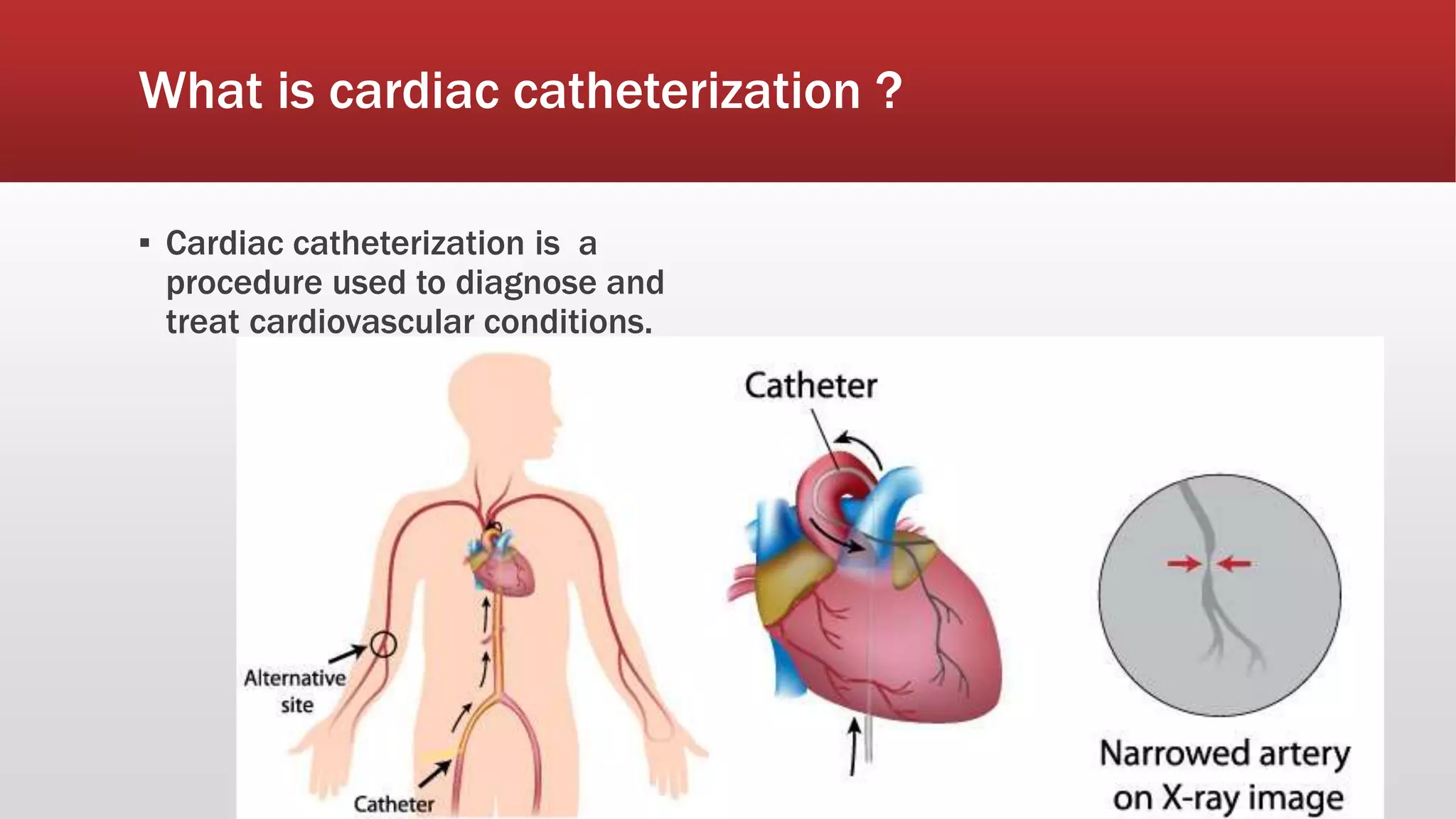 Arrhythmia cardiac catheterization holter_ | PPTX