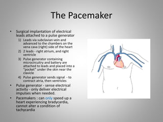 Open Pacemaker Pocket Antiarrhythmic drugs - drdhriti | PPTX