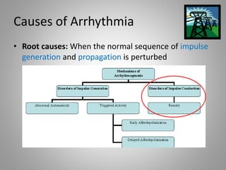 Causes of Arrhythmia
• Root causes: When the normal sequence of impulse
generation and propagation is perturbed
 