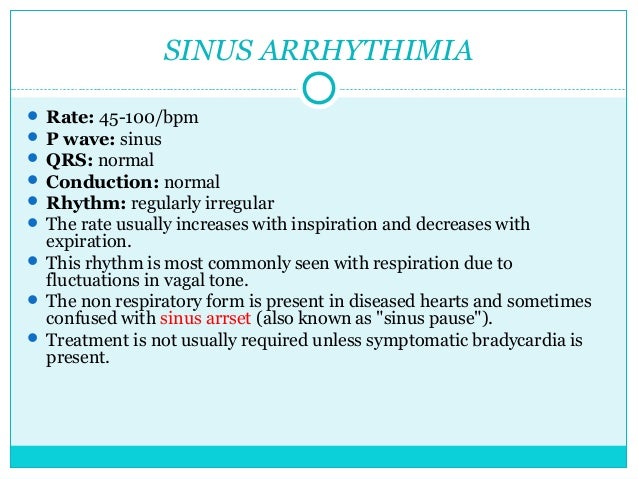 Arrhythmia Diagnosis And Management