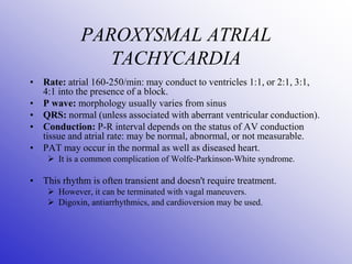 Arrhythmia Diagnosis and Management.ppt