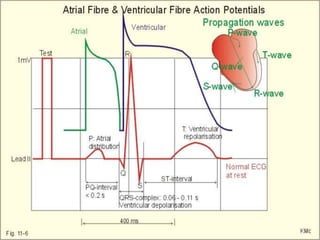 Arrhythmia | PPTX