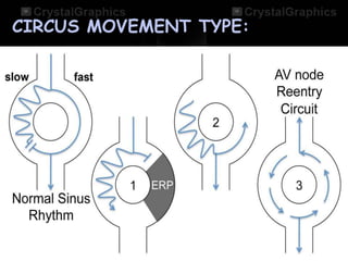 CIRCUS MOVEMENT TYPE:
 