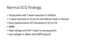 Arrhythmia for undergraduates | PPTX