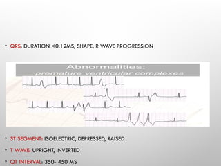 Inverted Qt Basics of Arrhythmia Medical Students2.pptx