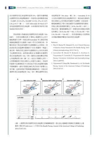 No.036THRS8 中華民國心律醫學會 ‧Taiwan Heart Rhythm Soclety‧ 中華民國 108 年 12 月出刊
而非選擇性希氏束起搏則達到 35%，儘管有趨勢偏
向選擇性希氏束起搏組較好，但結果未達到顯著意義
（S-HBP: 23/118,18%; NS-HBP: 81/232, 35%, CI: 0.87-
2.20, p=0.17，圖二）。由於 Infra-nodal AV block 並不
容易達到選擇性希氏束起搏，未來需要更多研究才能
知道是否真有差別。
　　然而即便只考慮達成非選擇性希氏束起搏（NS-
HBP），有時也很難光靠 12 導程心電圖和右心室中
膈起搏進行分辨，因此近期 Jastrzębski 等人嘗試用電
刺激偵測絕對不反應期（ERP）的方式來做分析。多
數的狀況下希氏束的絕對不反應期較右心室要長，因
此當從希氏束起搏的電極給予 S1S2 刺激時，理論上
會出現一個希氏束已達到不反應期但右心室尚未達到
不反應期的狀況，此時會由較長 S2 刺激的非選擇性
希氏束起搏波型（His + RV）隨著 S2 縮短轉為單純
心室起搏波型（RV，圖三 A）；而在正常竇性心律下，
正常傳導路徑中希氏束較右心室提早去極化，若兩者
的絕對不反應期相差不大則在給予希氏束起搏的電極
早期刺激時，就有可能僅去極化希氏束而不影響右心
室中膈，這意味著當早期刺激逐漸縮短時，可能由非
選擇性希氏束起搏波型（His + RV）轉為選擇性希氏
束起搏波型（His alone，圖三 B）。Jastrzębski 在 36
人次的非選擇性希氏束起搏研究中，僅有兩位個案的
希氏束較右心室有較長的絕對不反應期，在前述第一
種電刺激模式下除了兩位絕對不反應期特殊的個案，
其他人都出現預期的變化（34/36, His+RV → RV）；
然而在第二種電刺激模式中，則僅有部分個案出現相
反的變化（20/34, His+RV → His; 11/34, His+RV → RV;
3/34, His+RV → His+RV）。利用電刺激法可能幫助
未來臨床醫師判斷是否成功希氏束起搏。
Reference
1. Beer D, Sharma PS, Subzposh FA, et al. Clinical Outcomes
of Selective Versus Nonselective His Bundle Pacing. JACC
Clinical electrophysiology 2019;5:766-74.
2. Jastrzebski M, Moskal P, Bednarek A, Kielbasa G,
Vijayaraman P, Czarnecka D. Programmed His Bundle
Pacing. Circulation Arrhythmia and electrophysiology
2019;12:e007052.
3. Vijayaraman P, Chung MK, Dandamudi G, et al. His Bundle
Pacing. Journal of the American College of Cardiology
2018;72:927-47.
( 圖一 ) 選擇性與非選擇性希氏束起搏之詳細圖解說明，請注意心電圖藍色相較紅色圈圈之心電
圖多了微小的 delta wave。( 引用自 His Bundle Pacing. Journal of the American College of Cardiology
2018;72:927-47)
 