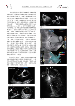 中華民國心律醫學會 ‧Taiwan Heart Rhythm Soclety‧ 中華民國 111 年 3 月出刊
( 圖三 )
( 圖ㄧ )
( 圖二 )
( 圖五 )
( 圖四 )
血管內超音波的引進是促成無輻射心房顫動電燒
手術的基石。複雜性的心房顫動電燒一個很重要的步
驟是心房中膈穿刺術。此一步驟在過去仰賴 X 光的定
位與右心房血管攝影的輔助才能準確的定位心房中膈
的位置，進一步做安全的穿刺動作。在血管內超音波
的技術引進之後，心房中膈穿刺可以完全仰賴超音波
的輔助進行。手術者須將血管內超音波探頭移至右心
房的傳統 home view( 圖一 )，此時可以觀察到右心房，
三尖瓣與右心室。再將血管內超音波探頭輕微順時鐘
轉 ( 圖二 )，此時可以看到心房中膈以及左心耳和左肺
靜脈，這也是之後做穿刺時需要用的方向。此時進一
步將血管內超音波向上伸再向後與向右側彎曲，即可
觀察到上腔靜脈與右心耳的分開處。( 圖三 ) 手術者在
這個影像下可以看著導絲 (wire) 進入上腔靜脈而非右
心耳，再進一步將長鞘管放置入上腔靜脈，準備換入
穿刺針頭。換好穿刺針頭之後，在血管內超音波的輔
助下，將針頭下移至心房中膈，進行穿刺動作。完成
無輻射線的穿刺動作之後，手術者可以依賴超音波建
立的三度空間定位影像進行手術 ( 圖四 )，或者是用多
極電燒導管融合斷層影像建立可信的三度空間定位進
行肺靜脈隔離手術。此外心房顫動常見合併的三尖瓣
峽部相關心房撲動，在血管內超音波下也可以清楚的
看到電燒的位置。( 圖五 )
然而值得注意的是，即使這些先進的技術讓無輻
射線或是低輻射線的電燒手術可以順利的進行，X 光
仍然是具有無法取代的功能。例如電燒手術前的心血
管檢查或是不尋常的血管變異…. 等等，必要時仍然是
需要 X 光機器的輔助，確保病人安全。
2 NO.045
 