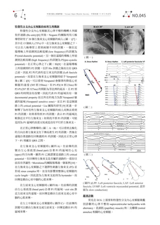 中華民國心律醫學會 ‧Taiwan Heart Rhythm Soclety‧ 中華民國 111 年 3 月出刊
特發性分支內心室頻脈的病理生理機制
特發性分支內心室頻脈其心律不整的機轉大多歸
咎於迴路 (Re-entry)[6] 所致。Nogami 的團隊利用八極
導管研究了 20 個左後束支心室頻脈的病人 ( 圖一 )[7]。
其中在 15 個病人 (75%) 中，在左後束支心室頻脈之下，
可以在八極導管上看到兩個不同的訊號，一個在近
端導極上所偵測到比較低頻 (low frequency) 的訊號為
P1(mid-diastolic potential)，另一個在遠端的導極上所偵
測到比較高頻 (high frequency) 的訊號為 P2(pre-systolic
potential)。在正常心律之下 ( 圖二 B)[8]，在遠端導極
上所偵測到的 P2 訊號，位於 His 訊號之後而且在 QRS
之前，因此 P2 所代表的是左束支的訊號 (Left fascicle
potential)。而當在左後束支心室頻脈時給予 Verapamil
後 ( 圖三 )[8]，可以看到 Verapamil 會顯著的降低心室
頻脈的速度 (305 到 350ms)，但 P1-P2(18 到 23ms) 和
P2-P1(287 到 327ms) 的間距為等比例的延長，且 P2 到
QRS 的時間沒有改變。因此代表 P1 的區域具有一個
decremental property 而且所在的地方為對 Verapamil 敏
感的區域 (Verapamil sensitive zone)，並且 P1 是這個迴
路上的 critical potential。Liu 團隊的研究 [9] 更進一步
解釋了為何有些左後束支心室頻脈的病人尚無法看到
P1 的訊號。如果看得到 P1 的訊號，表示 P1 的區域比
較靠近且平行左後束支；如果找不到 P1 的訊號，可能
是因為 P1 區域的長度太短或是沒有平行於左後束支。
在正常心律傳導時 ( 圖二 A、B)，可以看到去極化
的方向沿著左後束支往下傳而產生 P2 的訊號，然後在
遠端沿著迴路往回傳遇到 P1 的訊號。因此在正常心律
下，P1 埋藏在 QRS 之間。
在左後束支心室頻脈時 ( 圖四 A)，往前傳的訊
號 由 左 心 基 底 部 (basal part) 沿 著 P1 的 區 域 往 心 尖
(apex) 的方向傳。雖然 P1 已被證實是迴路上的 critical
potential，往回傳時左後束支是否屬於迴路的一部份目
前具有爭議性。
Morishima的團隊報導過一個案例[10]，
在左後束支心室頻脈之下選擇性刺激左後束支 (P2) 並
形成 sinus complex 時，並沒有影響到整個心室頻脈的
cycle length，因此認為左後束支此時為 bystander，而
回傳是藉由心室中膈的心肌來傳。
在左前束支心室頻脈時 ( 圖四 B)，往前傳的訊號
由左心基底部 (basal part) 沿著 P1 的區域，exit site 靠
近左前束支的遠端，而回傳是藉由左前束支或心室中
膈的心肌來傳。
在左上中隔束支心室頻脈時 ( 圖四 C)，往前傳的
訊號可以藉由左後束支或左前束支，回傳是藉由 P1 的
區域來傳。
鑑別診斷
常見在 ECG 上需要和特發性分支內心室頻脈做鑑
別診斷的心律不整如 supraventricular tachycardia with
aberrancy、乳頭肌 (papillary muscle) 和二尖瓣環 (mitral
annulus) 相關的心室頻脈。
( 圖一 )
( 圖二 )
( 圖三 )
( 圖四 )(LPF: Left posterior fascicle; LAF: Left anterior
fascicle; LVMP: Left ventricle myocardial potential; 波形
線為 slow conduction)
6 NO.045
 