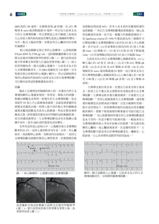 No.041
THRS
6 中華民國心律醫學會 ‧Taiwan Heart Rhythm Soclety‧ 中華民國 110 年 3 月出刊
圖一、病人胸痛時，心電圖呈現左支傳導阻斷。
血管攝影呈現冠狀動脈左前降支近端有明顯狹窄
( 圖二 )，進行血管成形術合併塗藥支架置入後，血
管狹窄改善 ( 圖三 )。
圖四、隔天追蹤病人心電圖，左前束支為主的左支
傳導阻斷消失，呈現無明顯傳導阻斷。
QRS 段約 186 毫秒，在側壁表現 qR 狀態，在 aVL 導
極到 R wave 最高點超過 45 毫秒，所以為左前束支為
主的左支傳導阻斷，所以預期是心室中膈最上面或是
左心室前上壁的病兆缺血性變化造成心電圖新的變化。
另外，配合上臨床狀態，其實是符合心臟再同步治療
的適應症。
病人抽血檢驗呈現正常的心肌酵素，心衰竭指數
NT-pro BNP 為 5700 pg/ mL。冠狀動脈攝影顯示在左前
降支近端有明顯再狹窄的情形 ( 圖二 )，進行血管成形
術合併塗藥支架再置入打通血管狹窄後 ( 圖三 )，病人
症狀明顯改善。隔天追蹤心電圖中，左前束支為主的
左支傳導阻斷消失，且 QRS 段縮短至 120 毫秒，完全
恢復至與之前相同的心電圖 ( 圖四 )，所以這個病例呈
現因心肌缺血所造成的左前束支為主的左枝傳導阻斷，
可以藉由改善冠狀動脈灌流而消失。
討論
臨床上在處理急性胸痛的病人時，若遇有合併左支
傳導阻斷的心電圖表現時，常常是一個很大的困擾，
根據治療觀念及準則，新發生的左支傳導阻斷，是必
須當作 ST 段上升心肌梗塞來處置，也就是需要儘快安
排緊急再灌流治療，時間上就不容許做太多的檢驗或
處置來鑑別診斷是否真有心肌梗塞，然而在緊急導管
檢查之後，卻常發現其實並沒有明顯的冠狀動脈阻塞，
而且再灌流處理完，左支傳導阻斷也沒有在後續心電
圖中消失，甚至 QRS 段的寬度也沒有變化。
在所有急性冠心症病人中，心電圖呈現左支傳導阻
斷者約佔 2%，這些人通常較多為年老、女性、有心臟
病史、高血壓與心衰竭，有較高的出血傾向。1
而因左
支傳導阻斷而啟動的緊急心導管患者，其實假陽性緊
急啟動比例高達 44%，許多人並未真的有嚴重阻塞的
冠狀動脈。2
所以左支傳導阻斷應該要被視為一個心血
管危險度的表現，而不是一個獨立的風險預測因子。
而 Sgarbossa criteria 於 1996 年發表認為有三個條件可
以幫助診斷左支傳導阻斷病人是否為 ST 段上升心肌梗
塞，其中包含 : (1) 任意導程出現同向的 ST 段上升超
過 1mm，(2) 導極 V1、V2 或 V3 出現 ST 段下降超過
1mm，(3) 任意導極出現反向的 ST 段上升超過 5mm。3
左前束支為主的左支傳導阻斷心電圖表現為 : (1) 心
軸左偏 ( 約 -45 度至 -90 度 )、(2) 在 I 和 aVL 導極 qR
表現、(3) 在 II 及 III 及 aVF 導極 rS 表現、(4) 在 aVL
導極到 R wave 最高點超過 45 毫秒，而左後束支為主
的左傳導枝阻斷心電圖表現為 (1) 心軸右偏 ( 約 +90 度
至 +180 度 )、(2) 在 III 導極 qR 表現、(3) 在 I 導極 rS
表現。
左傳導支源自希氏束，並發出左前束支與左後束
支，原則上它不像右束支那麼容易受損而產生右支傳
導阻斷，左傳導支除非發生嚴重傷害，才會產生左支
傳導阻斷。4
若因心肌梗塞產生左支傳導阻斷，通常梗
塞的範圍是在前壁或前中膈壁，且是大範圍的受損，
很少見的情況下，如果傳導系統的近端是由房室竇動
脈供應的，那麼下壁或後壁的梗塞就有可能引起左支
傳導阻斷。5
而心肌梗塞時所發生的左支傳導阻斷通常
是永久性的，但是少數仍可能會回復，一般說來有左
支傳導阻斷的病人多為年紀較大的族群，原先就有結
構性心臟病，或心臟衰竭患者，在這樣的情形下，左
支傳導阻斷可能是來自於傳導組織老化、纖維化、心
肌缺氧、左心室再塑性或肥厚等原因造成。6
 
