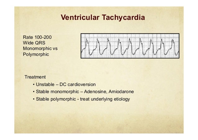 Arrhythmias