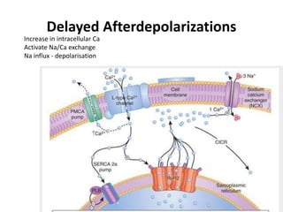 Delayed Afterdepolarizations
Increase in intracellular Ca
Activate Na/Ca exchange
Na influx - depolarisation
 