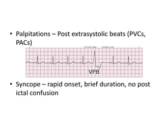 • Palpitations – Post extrasystolic beats (PVCs,
PACs)
• Syncope – rapid onset, brief duration, no post
ictal confusion
 