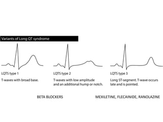 BETA BLOCKERS MEXILETINE, FLECAINIDE, RANOLAZINE
 