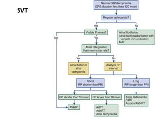 SVT
 