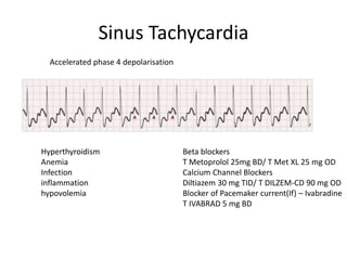 Sinus Tachycardia
Accelerated phase 4 depolarisation
Hyperthyroidism
Anemia
Infection
inflammation
hypovolemia
Beta blockers
T Metoprolol 25mg BD/ T Met XL 25 mg OD
Calcium Channel Blockers
Diltiazem 30 mg TID/ T DILZEM-CD 90 mg OD
Blocker of Pacemaker current(If) – Ivabradine
T IVABRAD 5 mg BD
 
