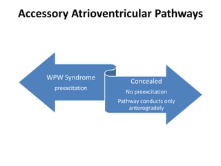 Accessory Atrioventricular Pathways
WPW Syndrome
preexcitation
Concealed
No preexcitation
Pathway conducts only
anterogradely
 