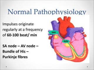 Normal Pathophysiology
SAN
AVN
Impulses originate
regularly at a frequency
of 60-100 beat/ min
SA node – AV node –
Bundle of His –
Purkinje fibres
 