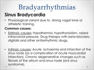 Bradyarrhythmias
Sinus Bradycardia
• Physiological variant due to strong vagal tone or
atheletic training.
Common causes:
• Extrinsic causes; Hypothermia, hypothyroidism, raised
intracranial pressure. Drug therapy with beta-blockers,
digitalis and other antiarrhythmic drugs.
• Intrinsic causes; Acute ischaemia and infarction of the
sinus node (as a complication of acute myocardial
infarction). Chronic degenerative changes such as
fibrosis of the atrium and sinus node (sick sinus
syndrome).
 