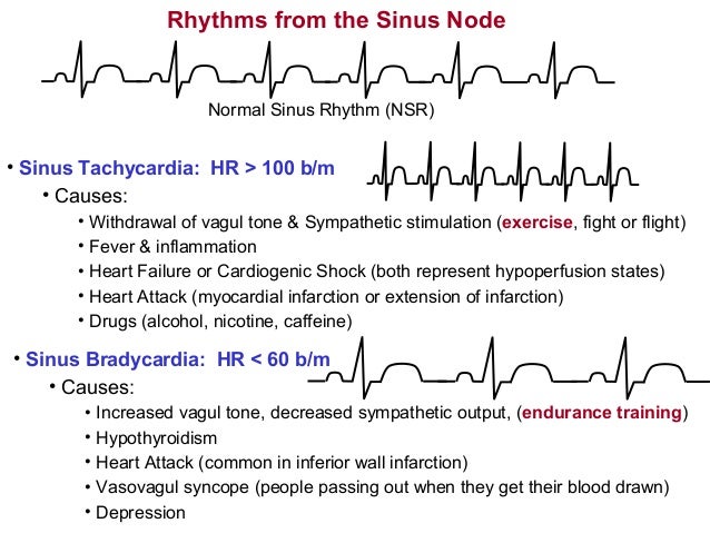 Arrhythmias19