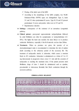  Pasting of the initial part of the QRS
 According to the morphology of the QRS complex, two Wolff-
Parkinson-White (WPW) types are distinguished: Type A, leads
V1 and V2 show predominant R waves. Type B, VI and V2 present
predominant S waves and positive delta wave in V5 and V6.
 Repolarization disorder.
 Etiology.- consequence of the existence of an anomalous (congenital)
pathway.
 Clinical picture: paroxysmal supraventricular tachyarrhythmia followed
by atrial fibrillation can often be asymptomatic or tachyarrhythmias (12-
80%). The higher the heart rate reached, the more likely it is to produce
ventricular fibrillation, especially if the R-R intervals are less than 200ms.
 Treatment.- When no premises are given, the practice of an
electrophysiological study is recommended to determine the risk of sudden
death according to the refractory period of the accessory life. The
treatment of tachycardia attacks is adenosine, which causes a transient
block in AV conduction. Adenosine is administered as a bolus of 3 to 12
mg intravenously in progressive doses every 2-3 min until the cessation of
tachycardia or reaching the maximum dose. If the patient presents atrial
fibrillation, drugs of class I should be administered such as ajmaline,
procainamide or intravenous flecainide that block conduction through the
accessory pathway.
FIBRILLATION HEADSET
 